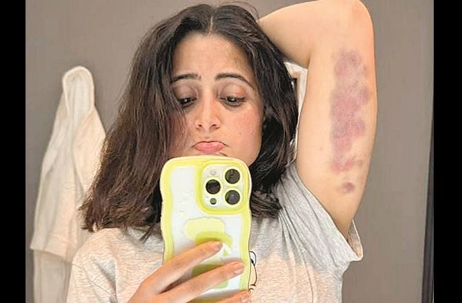 ایشوریہ شرما’خطروں کے کھلاڑی ‘ کی شوٹنگ کے دوران زخمی ہو گئیں